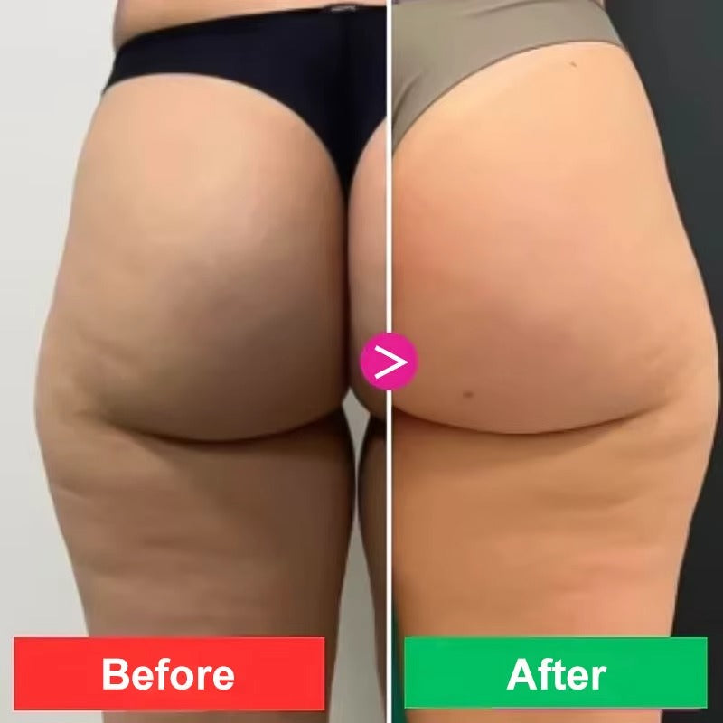 ADEUS CELLULITE CREAM