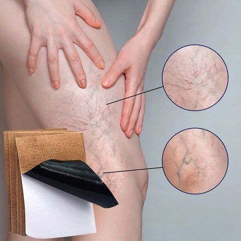 PARCHE PARA VENAS VARICES VARICOSE VEINS