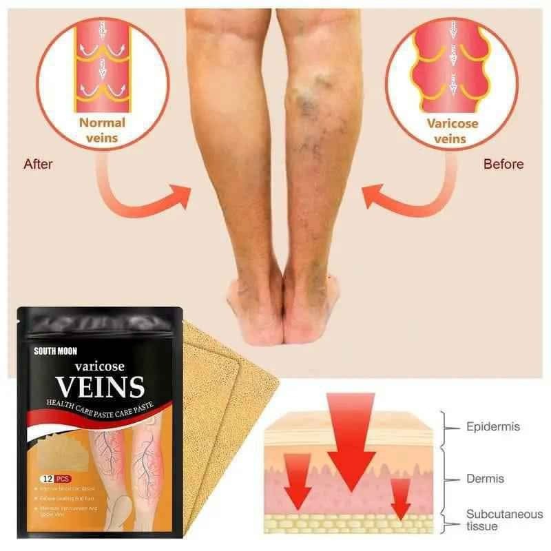 PARCHE PARA VENAS VARICES VARICOSE VEINS