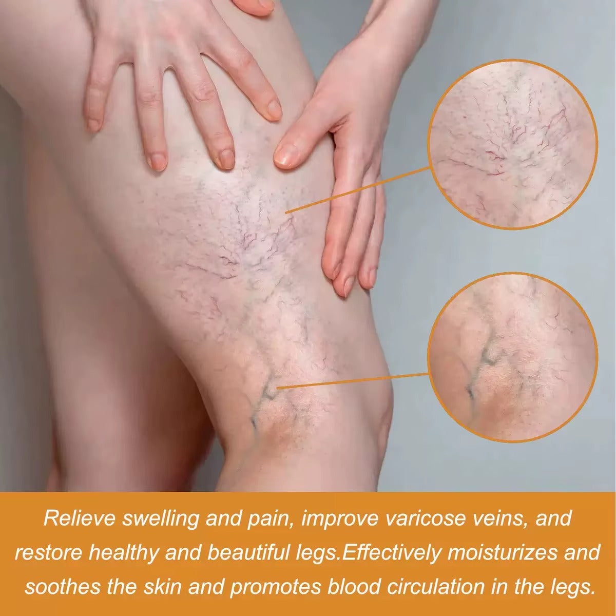 PARCHE PARA VENAS VARICES VARICOSE VEINS