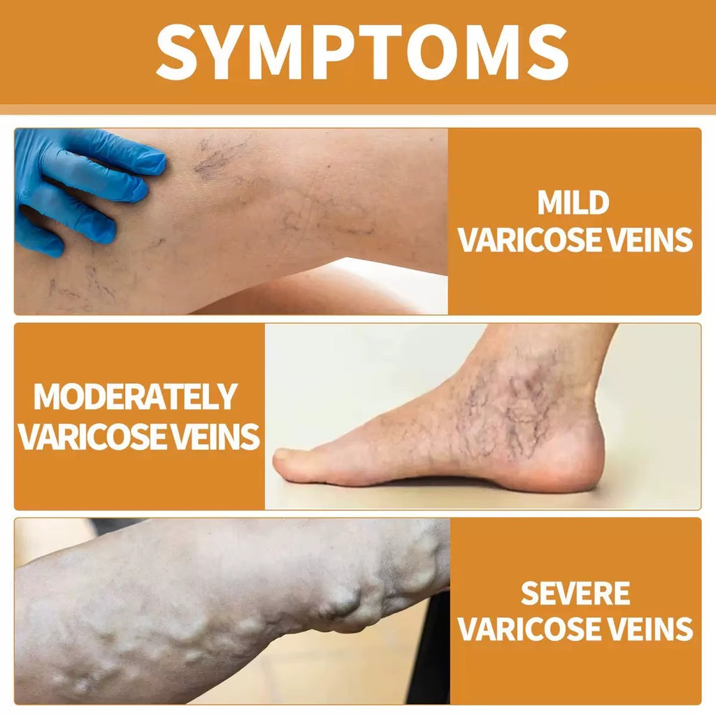 PARCHE PARA VENAS VARICES VARICOSE VEINS
